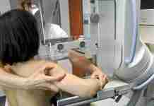 SAV organiza actividades para promover la salud femenina durante octubre